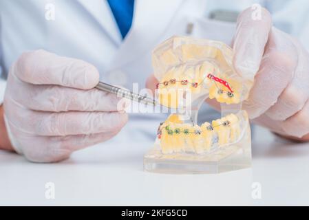 Il medico mostra come il sistema di bretelle sui denti è disposto Foto Stock