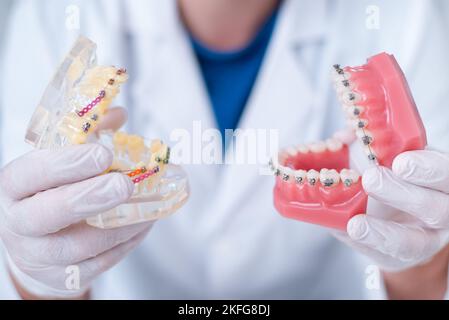 Il medico mostra come il sistema di bretelle sui denti è disposto Foto Stock