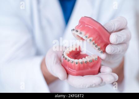 Il medico mostra come il sistema di bretelle sui denti è disposto Foto Stock