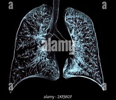 Polmoni sani, 3D CT scan Foto Stock