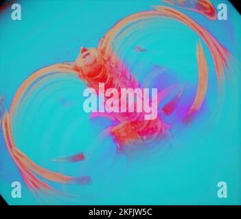 Gabbia toracica e colonna vertebrale, scansione TC 3D Foto Stock