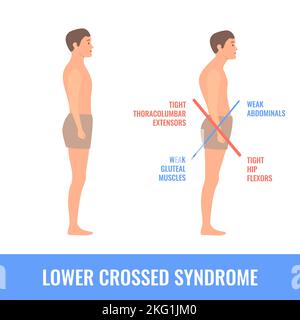 Uomo storto con sbilanciamento della sindrome più bassa incrociata Illustrazione Vettoriale