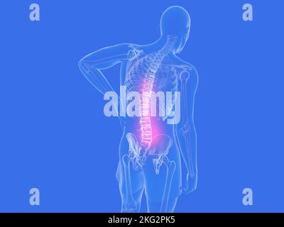 3D illustrazione dell'anatomia della schiena con dolore. Immagine trasparente delle ossa su sfondo blu. Foto Stock