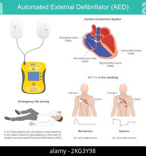 Defibrillatore esterno automatico. Si tratta di un dispositivo elettronico per il supporto vitale che riconosce la fibrillazione ventricolare e altre aritmie e fornisce Illustrazione Vettoriale