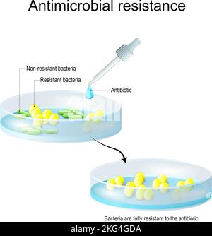 Resistenza antimicrobica. Batteri non resistenti e resistenti colonie di batteri prima e dopo la terapia antibiotica. Pipetta con antibiotico Illustrazione Vettoriale