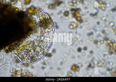 parassita umano. malattia da infezione intestinale. infezione da microrganismi in ospedale nelle persone Foto Stock