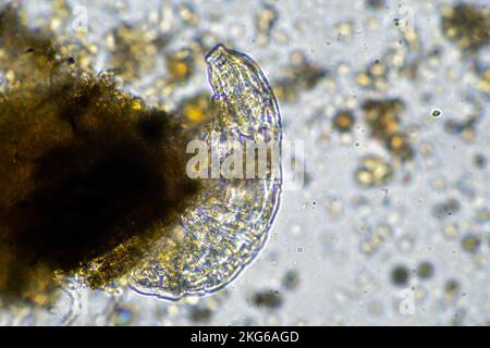 parassita umano. malattia da infezione intestinale. infezione da microrganismi in ospedale nelle persone Foto Stock