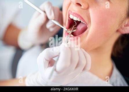 Sembra che Weve abbia trovato una cavità. Primo piano di una giovane ragazza che ha un controllo al dentista. Foto Stock