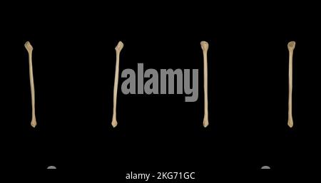 Fibula destra: Viste multiple Foto Stock