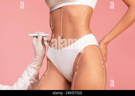 Il medico che disegna i contrassegni di linea tratteggiati sul corpo della femmina prima dell'operazione di chirurgia plastica Foto Stock