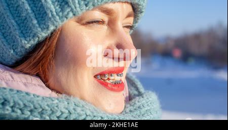 La ragazza ha dei rinforzi sui denti. Una ragazza in inverno sulla strada sorride e bretelle sono visibili sui suoi denti. Denti lisci dall'installazione di Foto Stock