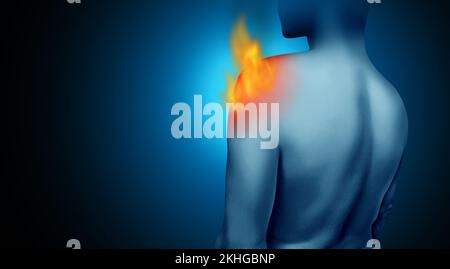 Bruciore dolore alle spalle e dolore alle articolazioni della cuffia del rotatore e lesioni ai tendini come infiammazione cronica del dolore bruciante dovuta a una lesione o a un incidente sul lavoro Foto Stock