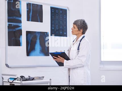 L'importanza della radiologia in medicina. una dottoressa che studia i raggi x. Foto Stock