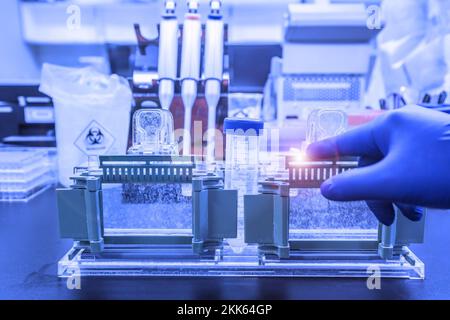 Analisi Western blot utilizzare come analisi delle proteine per il rilevamento delle proteine. Questa tecnica viene utilizzata in laboratori medici o di ricerca. Inoltre, il metodo rileva l'HIV Foto Stock