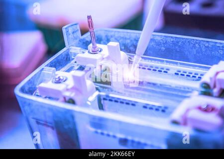 Analisi Western blot utilizzare come analisi delle proteine per il rilevamento delle proteine. Questa tecnica viene utilizzata in laboratori medici o di ricerca. Inoltre, il metodo rileva l'HIV Foto Stock