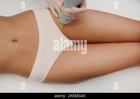 Depilazione laser Foto Stock