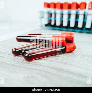 Una pila di provette per analisi del sangue con tappo rosso sulla scrivania nel laboratorio di ematologia, concetto di laboratorio di ematologia sanitaria Foto Stock