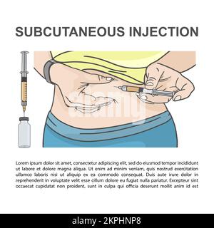 INIEZIONE SOTTOCUTANEA nella siringa addominale inserita a mano sotto Skin Educational Picture for Medical Facilities Students clip Art Vector Illustrati Illustrazione Vettoriale