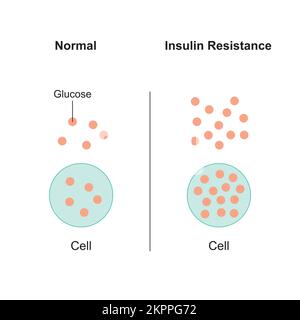 Concetto di resistenza all'insulina Design. Illustrazione vettoriale. Illustrazione Vettoriale