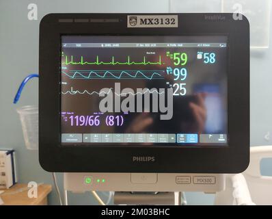 Moreno Valley, CA, USA - 26 novembre 2022: Moderno monitor portatile di assistenza sanitaria in ospedale Foto Stock