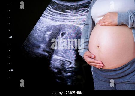 Donna incinta con apparecchiature ecografiche di base in ospedale Foto Stock