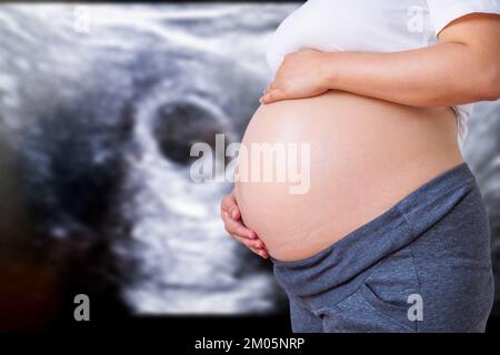 Donna incinta con apparecchiature ecografiche di base in ospedale Foto Stock