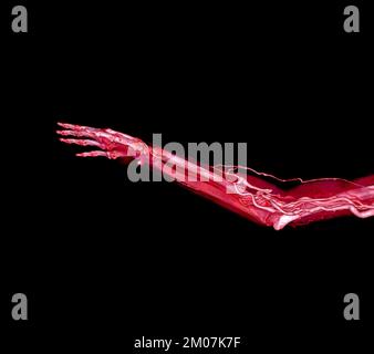 Arterie brachiali del braccio con rendering 3D dell'osso dell'estremità superiore dallo scanner TC. Foto Stock