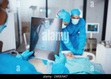 Team di medici, radiografia e chirurgia in ospedale con paziente in barella. Lavoro di squadra, assistenza sanitaria e medico con mammogramma, infermieri e. Foto Stock