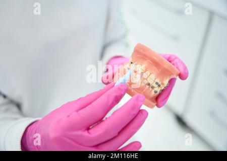 Il medico tiene nelle sue mani un modello della dentizione Foto Stock