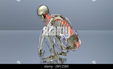 Concetto di anatomia del sistema di scheletro umano. Rosso sulla spina dorsale, illustrazione medica accurata di una colonna vertebrale dolorosa, male spina dorsale, Snatch, rendering 3D Foto Stock