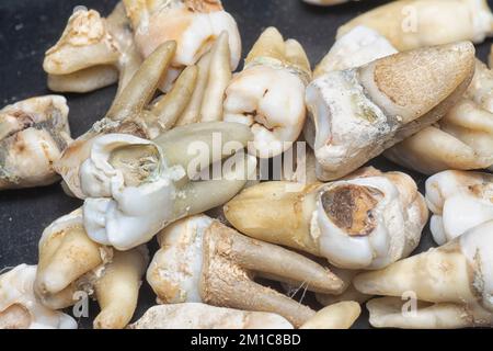 il fascio di denti umani di decadimento estratti indesiderati. Foto Stock