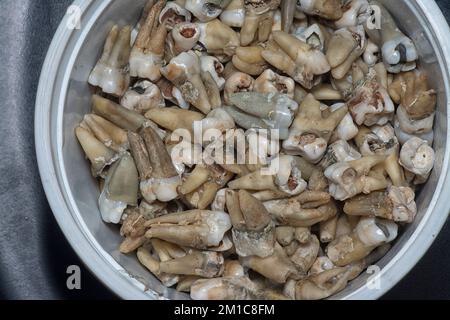 il fascio di denti umani di decadimento estratti indesiderati. Foto Stock