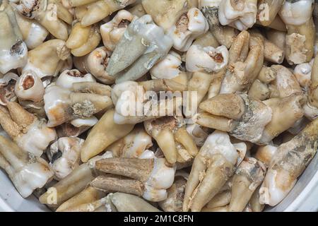 il fascio di denti umani di decadimento estratti indesiderati. Foto Stock