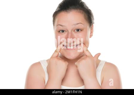 Giovane donna cubby costringendo il suo sorriso con le dita su sfondo bianco studio. Foto Stock