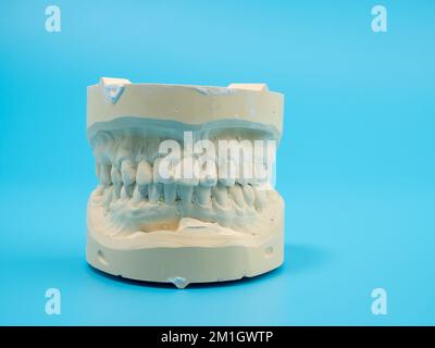 Getti dentali su sfondo blu. Modello di denti in gesso. Primo piano. Foto Stock