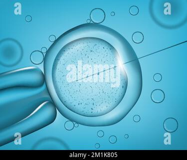 Iniezione dell'ago laser sulla cellula. Operazione medica. Ricerca sul DNA umano, biotecnologia e medicina, inseminazione artificiale sfondo vettoriale realistico con ago in cellula al microscopio Illustrazione Vettoriale