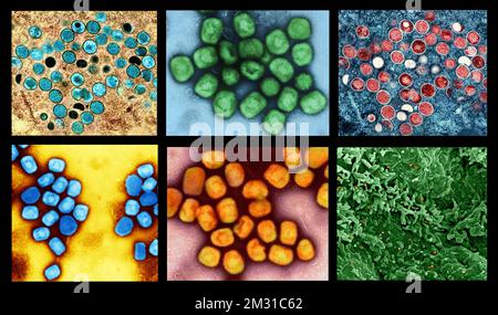 Un composito di immagini del virus del vaiolo. Una versione composita ottimizzata e migliorata di sei immagini a scansione di micrografia elettronica, Credit: NIAID Foto Stock
