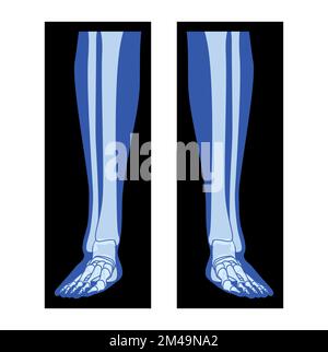 X-Ray gambe piede scheletro, fibula, tibia - falangi corpo umano, ossa persone adulte roentgen vista frontale. 3D concetto realistico di colore blu piatto immagine vettoriale di anatomia medica isolata su nero Illustrazione Vettoriale