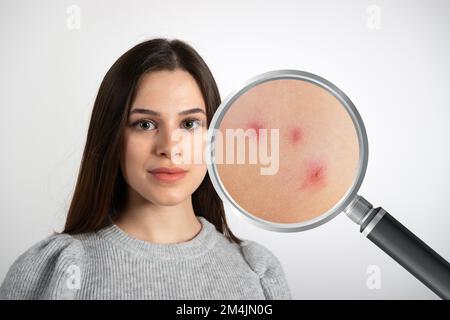 Ritratto di un giovane modello dove attraverso una lente d'ingrandimento si può vedere il pellev con problemi di demodicosi Foto Stock