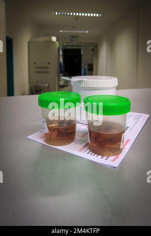 I campioni di tessuto vengono posti in formalina per il successivo esame da parte di un patologo dell'ospedale Foto Stock