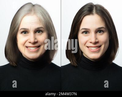 Donna prima e dopo un trattamento di ringiovanimento. Rughe, piedi di corvo, borse per gli occhi e segni di età. Linee di fronte e capelli grigi. Foto Stock