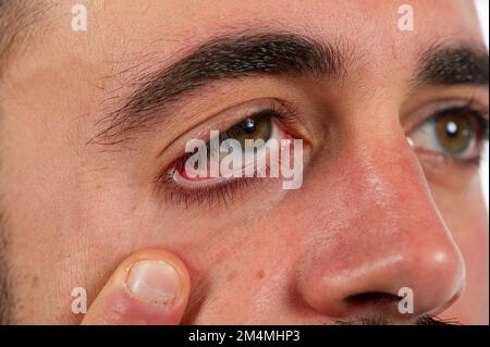 foto ravvicinata, sezione della testa, uomo che tira la pelle sotto gli occhi e mostra la congiuntiva rossa, isolato su sfondo bianco Foto Stock
