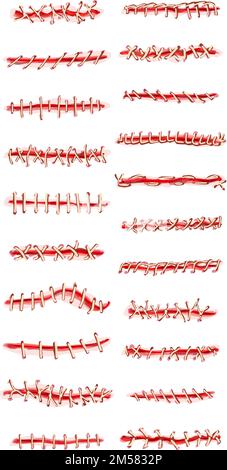 Le icone di sutura impostano il vettore dei cartoni animati. Chirurgia della ferita. Lacerazione del medico Illustrazione Vettoriale