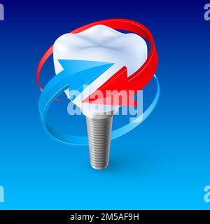 Concetto isometrico dell'icona dell'impianto dentale umano con una freccia rossa e una freccia blu. L'elemento per la progettazione del volantino, Banner, Pubblicità dei dentifrici Illustrazione Vettoriale