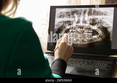 Radiografia panoramica dei denti dei bambini di due mascelle, ortopantomogramma dei denti dei bambini su schermi di computer portatile al tavolo del medico, diagnostica Foto Stock