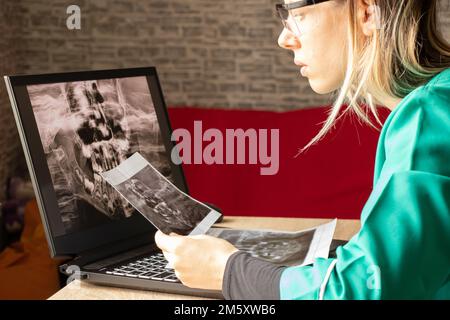 Radiografia panoramica dei denti dei bambini di due mascelle, ortopantomogramma dei denti dei bambini su schermi di computer portatile al tavolo del medico, diagnostica Foto Stock