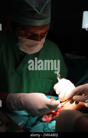 Trattamento della rottura del nervo e del vaso. Medico chirurgo di plastica tratta la mano facendo microchirurgia Foto Stock