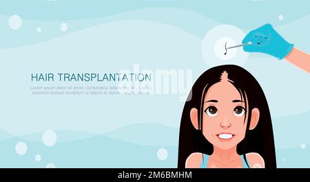 Ragazza con problemi di capelli, caduta, alopecia, danno, illustrazione del trapianto di capelli Illustrazione Vettoriale