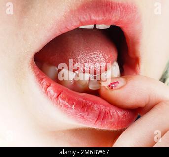 Primo piano di un dito che avverte una perdita di dente Foto Stock