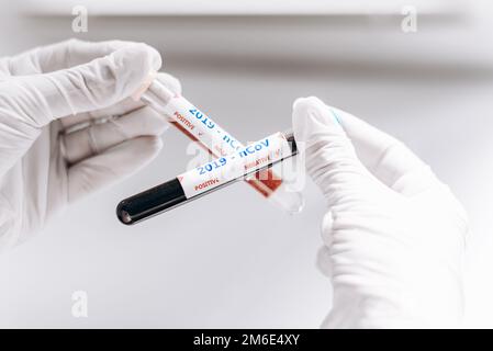 2019-nCoV Coronavirus. Campione di sangue positivo e negativo nella mano dei medici. Sindrome respiratoria. Coronavirus che si rompe Foto Stock